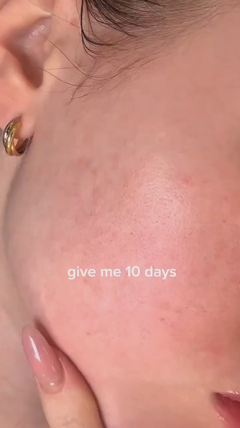 Centella SKIN 1004 Madagascar TONE BRIGHTENING Fresh Ampoule 100ml